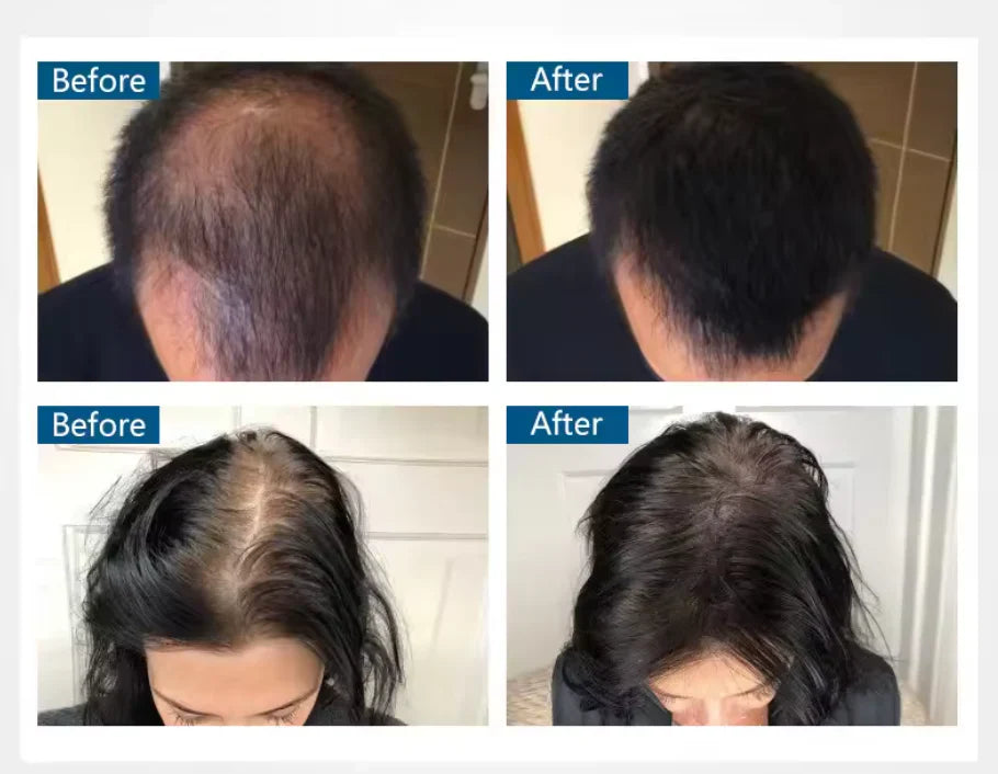 Toppik Hair Thickening – For fyldigere og sunnere hår på et øyeblikk!