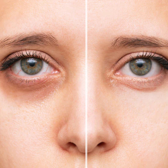Luminous Eye Corrector – din 30-sekunders lösning!