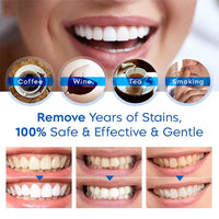PerfectSmile™ Teeth Whitening Stick 1+1 GRATIS!
