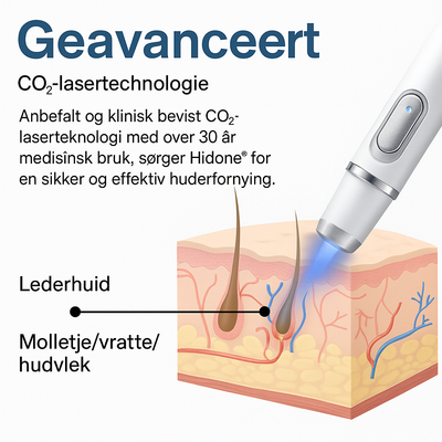 Hidone® Ikke-invasiv laserpenn for fjerning av føflekker og vorter