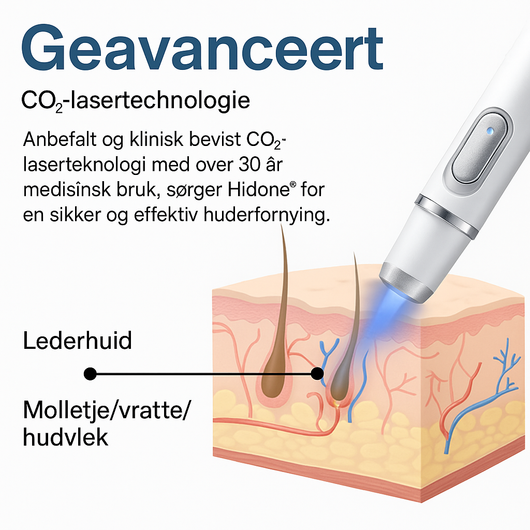 Hidone® Ikke-invasiv laserpenn for fjerning av føflekker og vorter