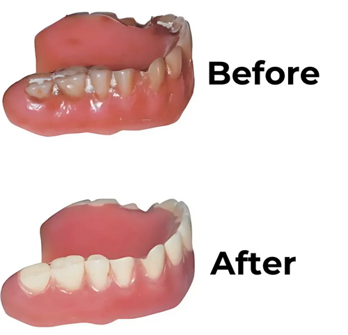 Velora DentaClean – Ultraljudsrengöring & UV-sterilisering