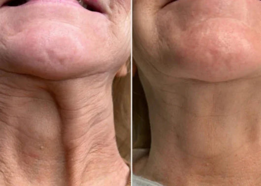 Velora Renove™ | El sérum antiarrugas que renueva tu piel desde la primera aplicación