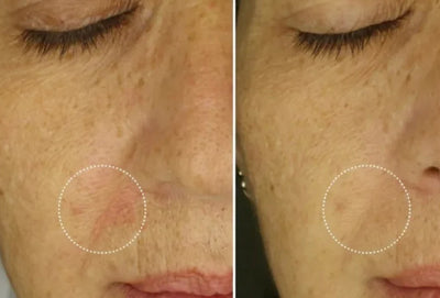 Velora Renove™ | El sérum antiarrugas que renueva tu piel desde la primera aplicación
