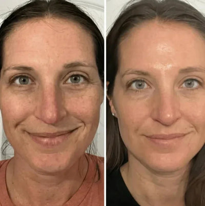 Velora PDRN Collagen Volume Balm