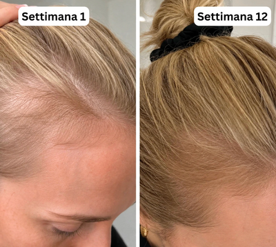 Tuve Siero Coreano n°1 per Crescita & Densità | Capelli più forti e più folti in 6 settimane