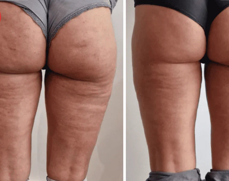 Verktøy for Guasha-massasje