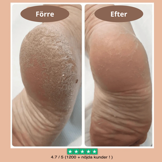 Säg Hejdå till Hälsmärta med CloudHeel™ – Din Lösning för Smärtsamma Fötter!