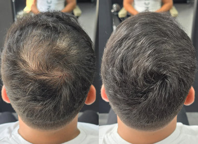 Nova™ Hairfillup  Naturlig Utseende og Vannavstøtende Beskyttelse