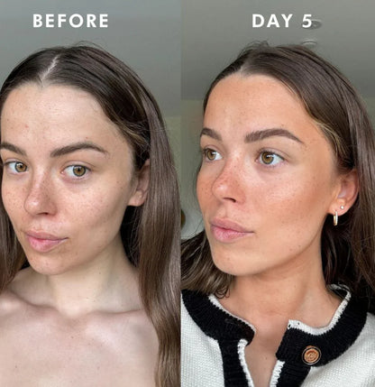 Brèzia™ – Din perfekta lyster utan sol, utan ränder, bara strålande hud