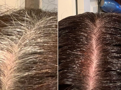 Bli av med grått hår på sekunder - Synlig återväxt. Äkta självförtroende!