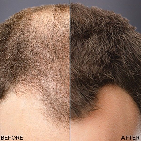 Toppik Hair Thickening – For fyldigere og sunnere hår på et øyeblikk!