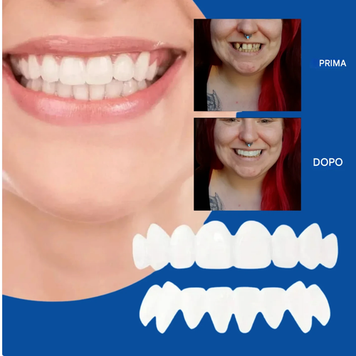 DentalFlex™ | Faccette Dentali Modulari per un Sorriso Perfetto